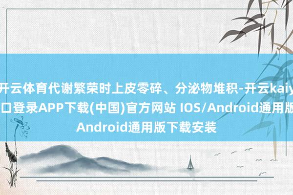 开云体育代谢繁荣时上皮零碎、分泌物堆积-开云kaiyun登录入口登录APP下载(中国)官方网站 IOS/Android通用版下载安装