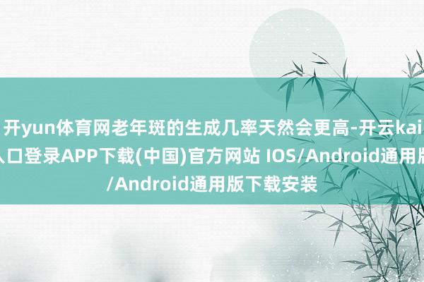 开yun体育网老年斑的生成几率天然会更高-开云kaiyun登录入口登录APP下载(中国)官方网站 IOS/Android通用版下载安装